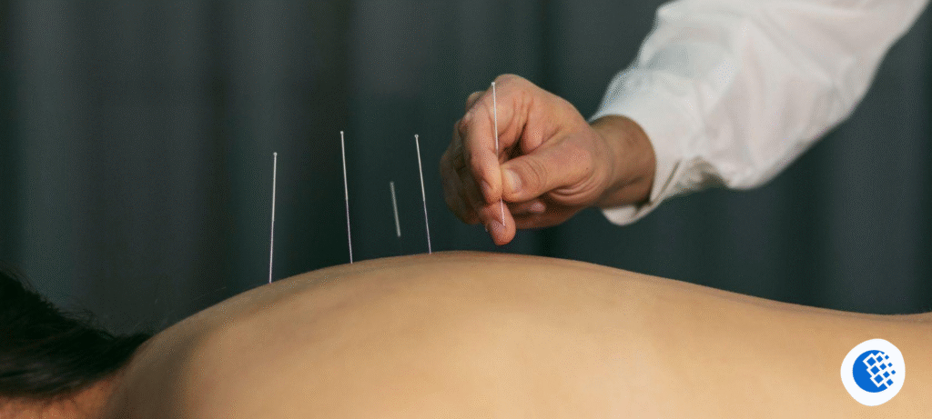 Acupuncture Services in New York