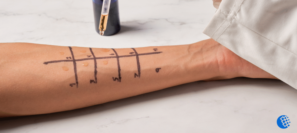 Why No Caffeine Before an Allergy Test: