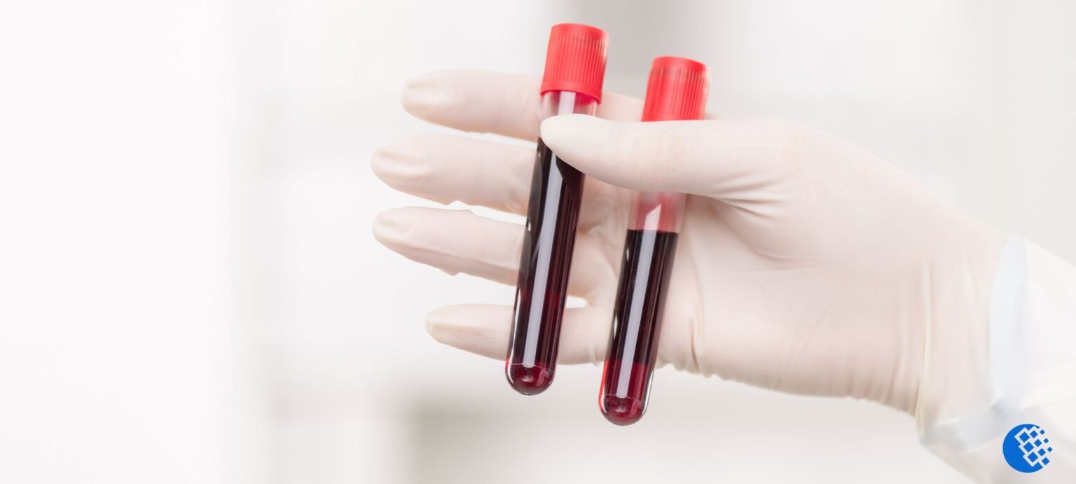 What is MCV in a Blood Test? (A Detailed Explain)
